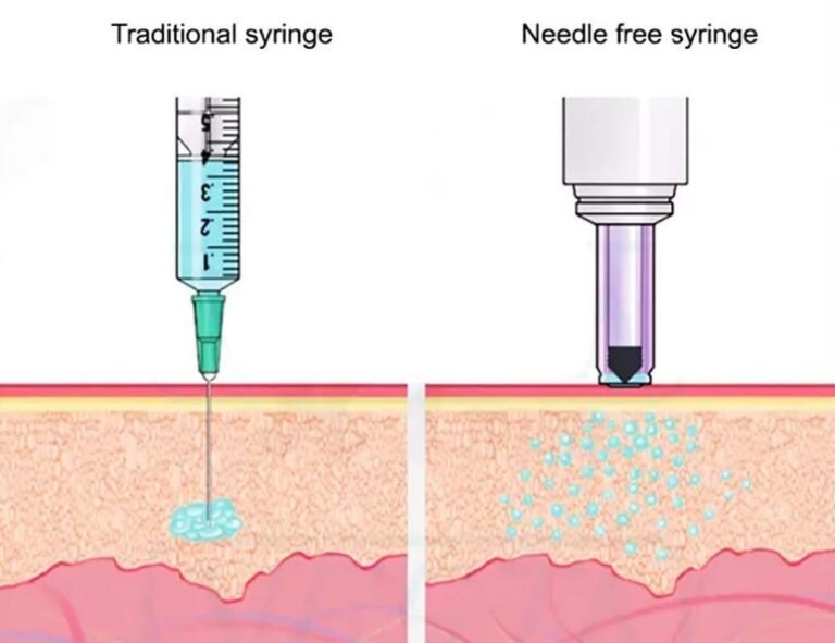 needle free filler